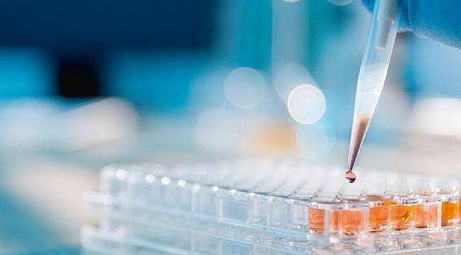 Kullanılmış yağ analizinden çıkan 4 ana mesaj