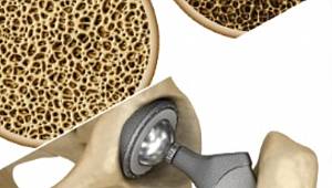 Sağlıkta Bor Uygulamaları Çalıştayı!