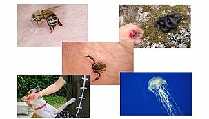 TÜKETİCİ: Arı – akrep – yılan sokmaları ve kedi - köpek ısırmalarında ne yapmalı?