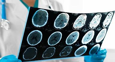 Enerji çalışanları ÖNEMLİ - Beyin kanaması önlenebilir mi?