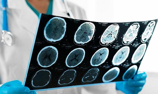 Enerji çalışanları ÖNEMLİ - Beyin kanaması önlenebilir mi?